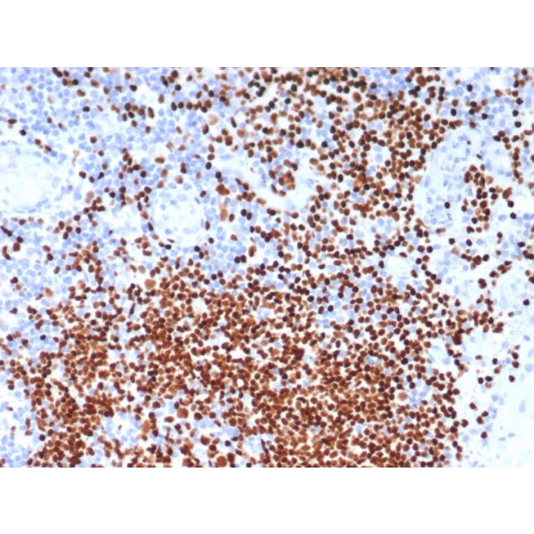 Immunohistochemistry - Anti-SOX11 Antibody [SOX11/7236] (A277801) - Antibodies.com