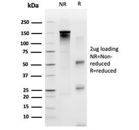SDS-PAGE - Anti-SP100 Antibody [PCRP-SP100-1B9] (A277802) - Antibodies.com