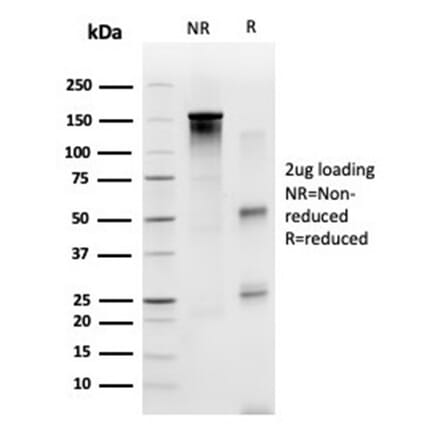 SDS-PAGE - Anti-SP100 Antibody [PCRP-SP100-1B9] (A277802) - Antibodies.com