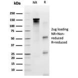SDS-PAGE - Anti-SP100 Antibody [PCRP-SP100-1B9] (A277802) - Antibodies.com