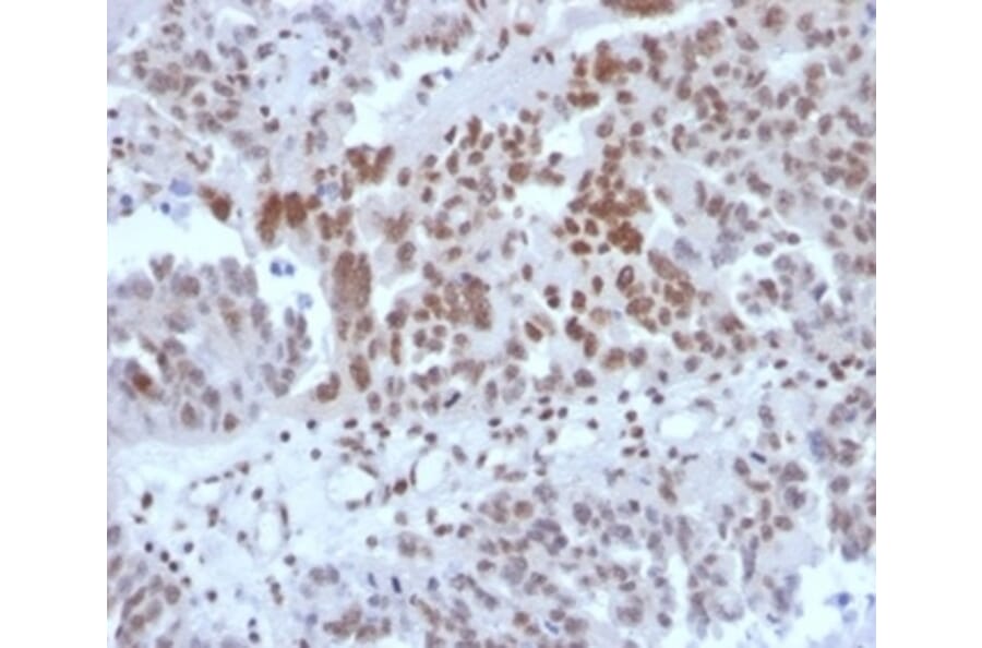 Immunohistochemistry - Anti-SP100 Antibody [PCRP-SP100-1B9] (A277802) - Antibodies.com
