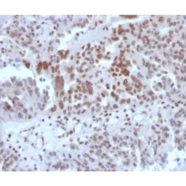 Immunohistochemistry - Anti-SP100 Antibody [PCRP-SP100-1B9] (A277802) - Antibodies.com