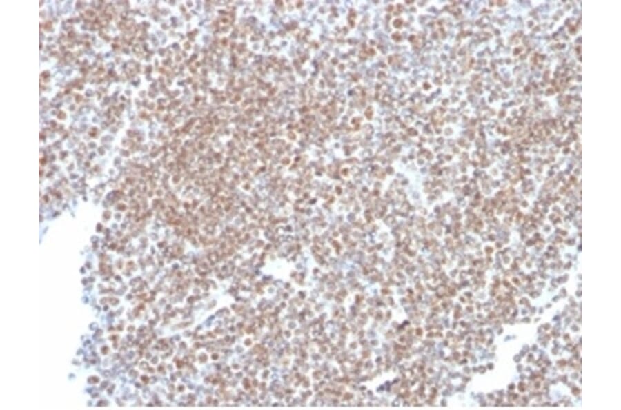 Immunohistochemistry - Anti-SP100 Antibody [PCRP-SP100-1B9] (A277802) - Antibodies.com