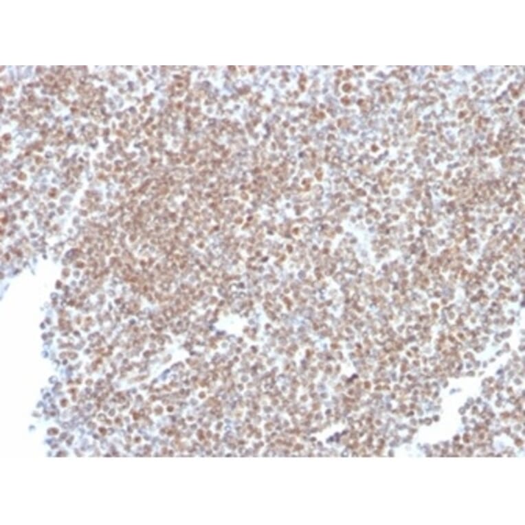 Immunohistochemistry - Anti-SP100 Antibody [PCRP-SP100-1B9] (A277802) - Antibodies.com