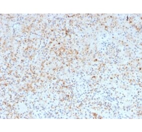 Immunohistochemistry - Anti-SPARC Antibody [OSTN/3932] (A277803) - Antibodies.com