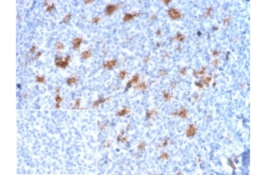 Immunohistochemistry - Anti-SPARC Antibody [OSTN/3932] (A277803) - Antibodies.com