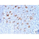 Immunohistochemistry - Anti-SPARC Antibody [OSTN/3932] (A277803) - Antibodies.com