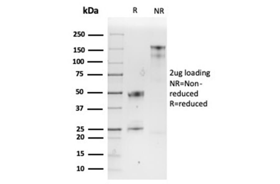 SDS-PAGE - Anti-SPARC Antibody [OSTN/3932] (A277803) - Antibodies.com