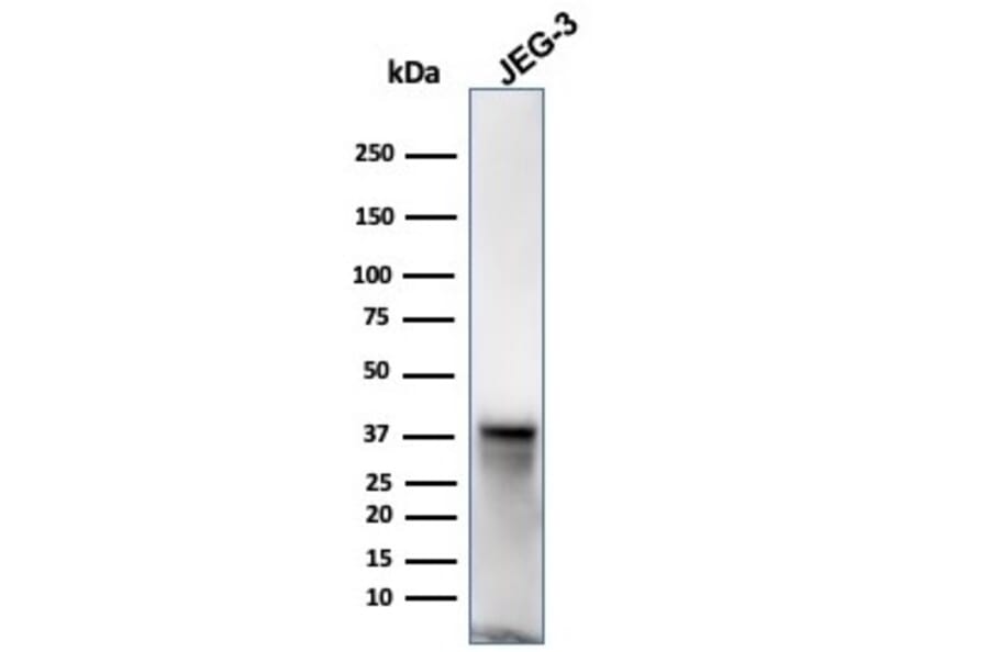 Western Blot - Anti-SPARC Antibody [OSTN/3932] (A277803) - Antibodies.com