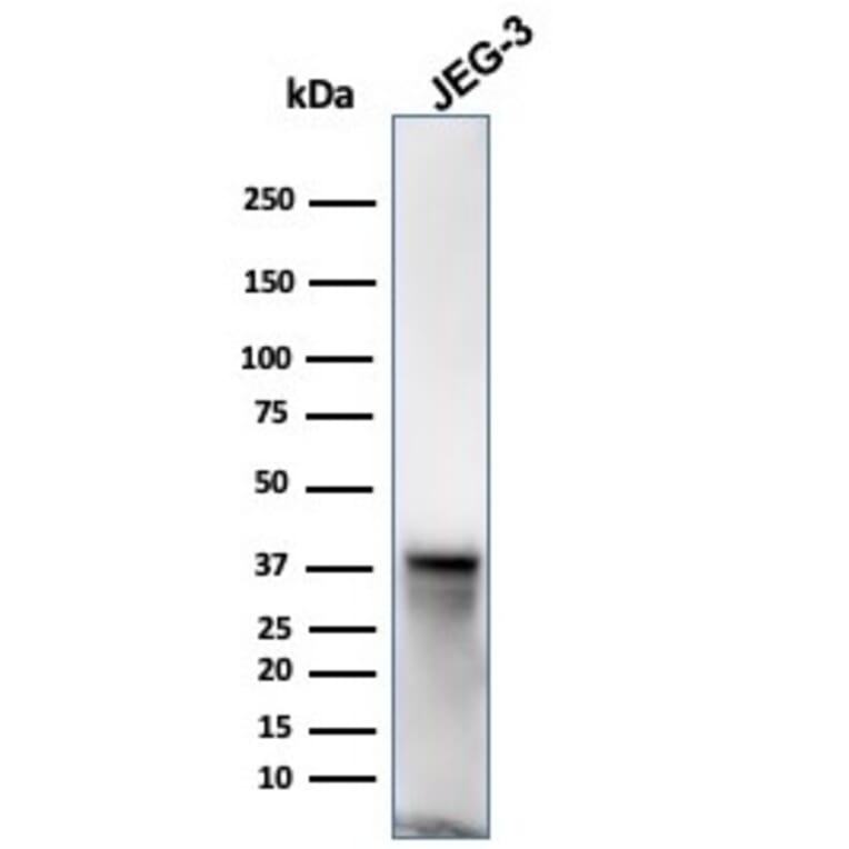 Western Blot - Anti-SPARC Antibody [OSTN/3932] (A277803) - Antibodies.com