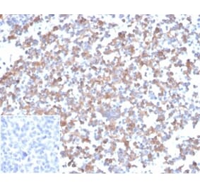 Immunohistochemistry - Anti-SPARC Antibody [OSTN/3933] (A277804) - Antibodies.com