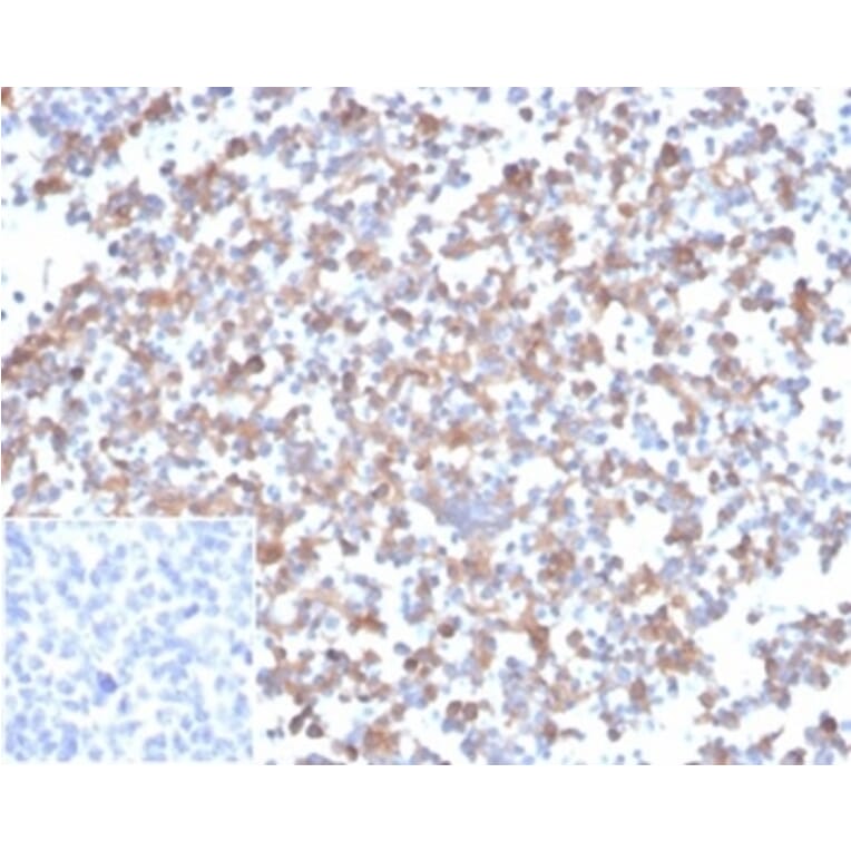 Immunohistochemistry - Anti-SPARC Antibody [OSTN/3933] (A277804) - Antibodies.com