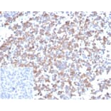 Immunohistochemistry - Anti-SPARC Antibody [OSTN/3933] (A277804) - Antibodies.com