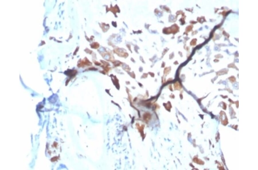 Immunohistochemistry - Anti-SPARC Antibody [OSTN/3933] (A277804) - Antibodies.com