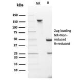 SDS-PAGE - Anti-SPARC Antibody [OSTN/3933] (A277804) - Antibodies.com