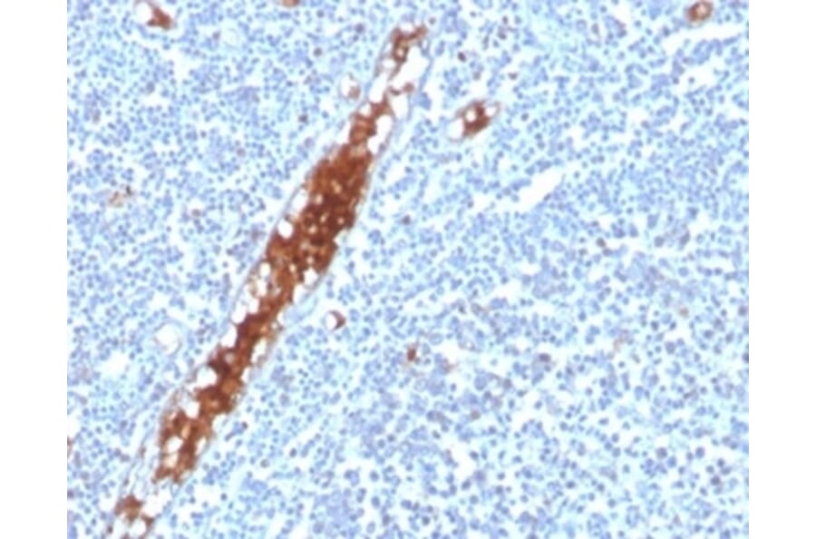 Immunohistochemistry - Anti-SPARC Antibody [OSTN/3304] (A277805) - Antibodies.com
