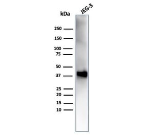 Western Blot - Anti-SPARC Antibody [OSTN/3758] (A277807) - Antibodies.com