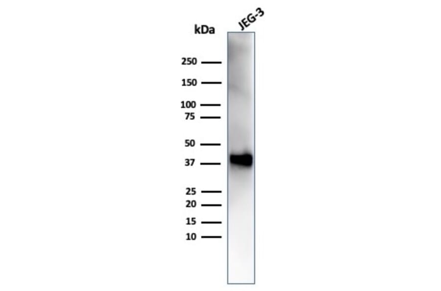 Western Blot - Anti-SPARC Antibody [OSTN/3758] (A277807) - Antibodies.com