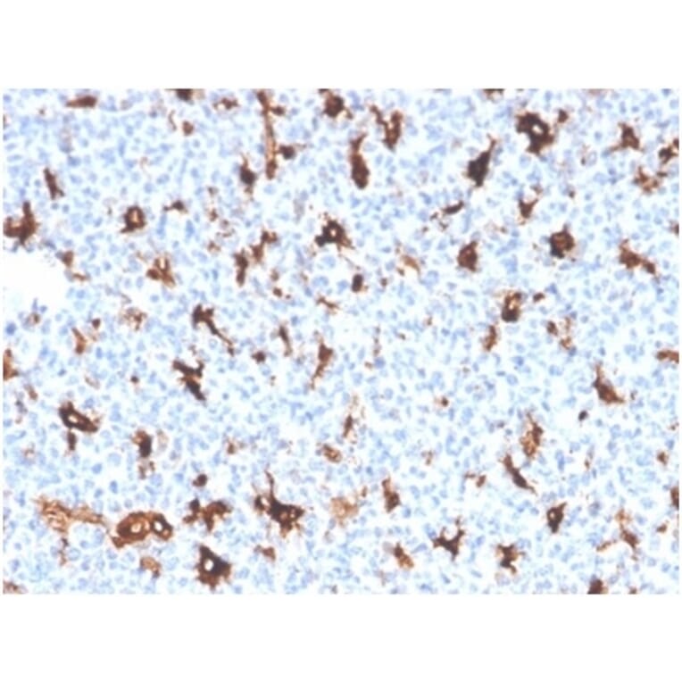 Immunohistochemistry - Anti-SPARC Antibody [OSTN/3758] (A277807) - Antibodies.com