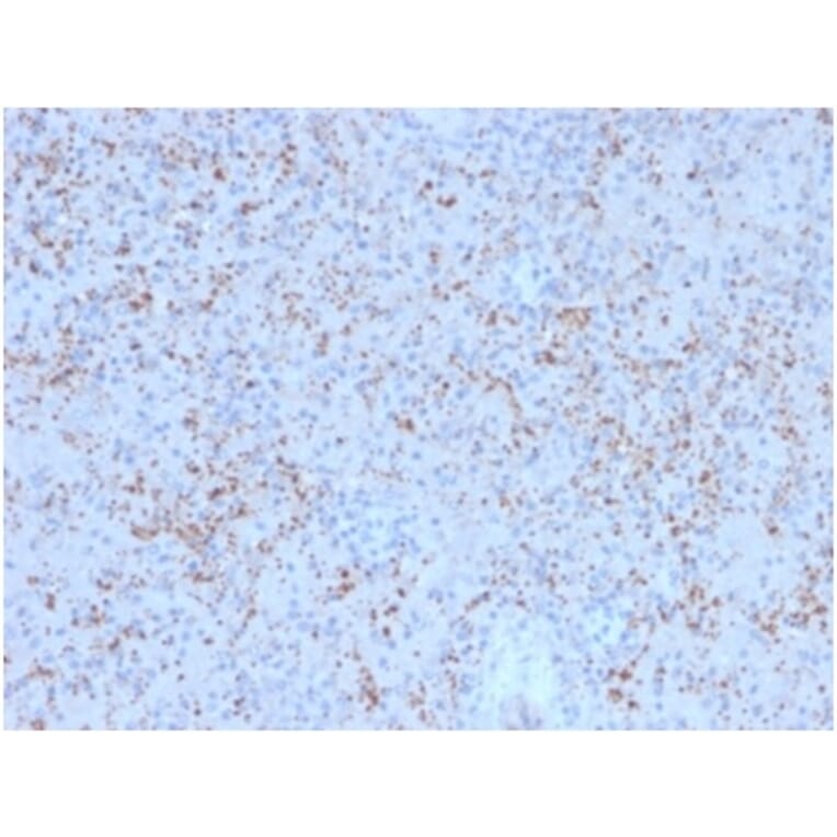 Immunohistochemistry - Anti-SPARC Antibody [OSTN/3758] (A277807) - Antibodies.com