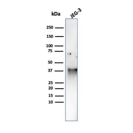 Western Blot - Anti-SPARC Antibody [OSTN/3759] (A277808) - Antibodies.com