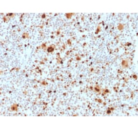 Immunohistochemistry - Anti-PU.1 Antibody [PU1/2118] (A277809) - Antibodies.com