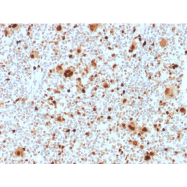 Immunohistochemistry - Anti-PU.1 Antibody [PU1/2118] (A277809) - Antibodies.com