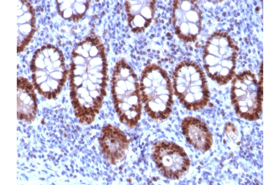 Immunohistochemistry - Anti-PU.1 Antibody [PU1/2118] (A277809) - Antibodies.com