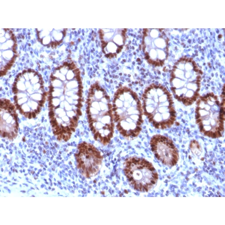 Immunohistochemistry - Anti-PU.1 Antibody [PU1/2118] (A277809) - Antibodies.com