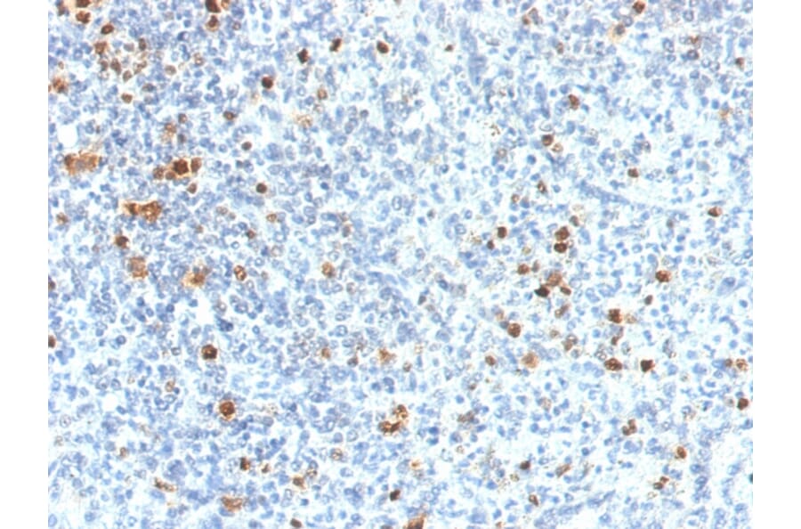 Immunohistochemistry - Anti-PU.1 Antibody [PU1/2118] (A277809) - Antibodies.com
