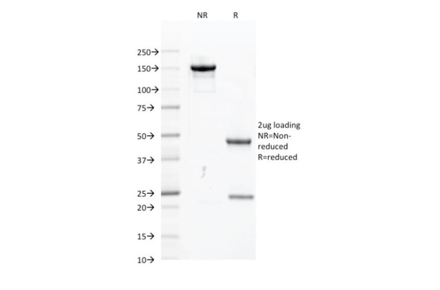 SDS-PAGE - Anti-PU.1 Antibody [PU1/2118] (A277809) - Antibodies.com