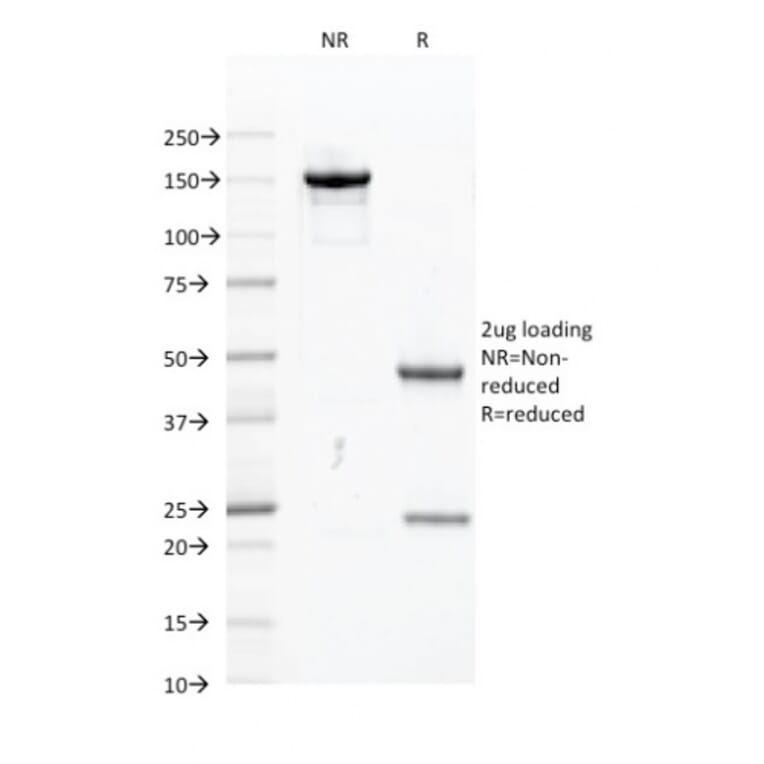 SDS-PAGE - Anti-PU.1 Antibody [PU1/2118] (A277809) - Antibodies.com