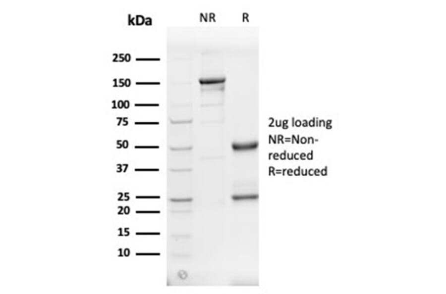 SDS-PAGE - Anti-alpha II Spectrin Antibody [SPTAN1/3505] (A277810) - Antibodies.com