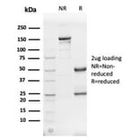 SDS-PAGE - Anti-alpha II Spectrin Antibody [SPTAN1/3505] (A277810) - Antibodies.com