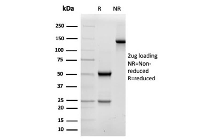 SDS-PAGE - Anti-alpha II Spectrin Antibody [SPTAN1/3506] (A277811) - Antibodies.com