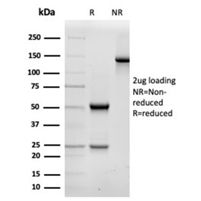 SDS-PAGE - Anti-alpha II Spectrin Antibody [SPTAN1/3506] (A277811) - Antibodies.com