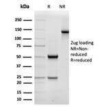 SDS-PAGE - Anti-alpha II Spectrin Antibody [SPTAN1/3506] (A277811) - Antibodies.com