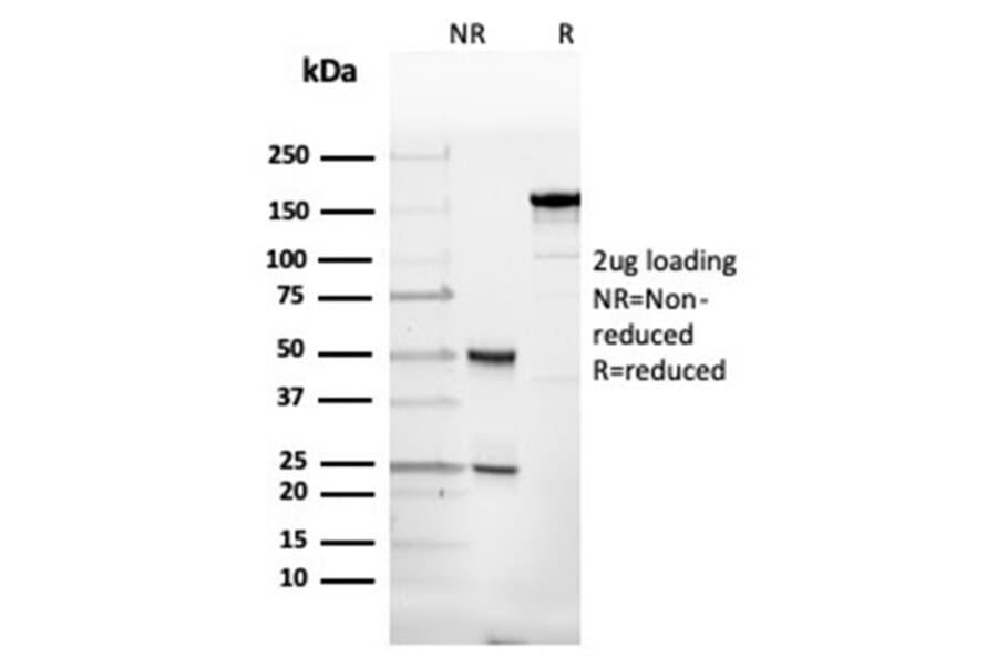 SDS-PAGE - Anti-alpha II Spectrin Antibody [SPTAN1/3507] (A277812) - Antibodies.com