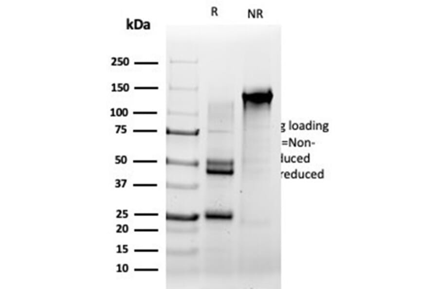 SDS-PAGE - Anti-Serum Response Factor Antibody [PCRP-SRF-1F1] (A277814) - Antibodies.com