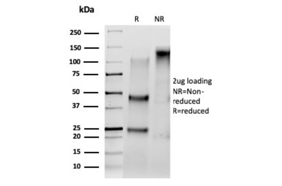 SDS-PAGE - Anti-Serum Response Factor Antibody [PCRP-SRF-1F7] (A277815) - Antibodies.com