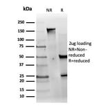 SDS-PAGE - Anti-MED22 Antibody [PCRP-MED22-1E4] (A277816) - Antibodies.com