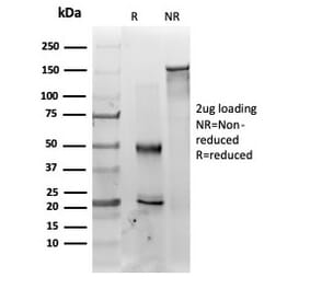 SDS-PAGE - Anti-MED22 Antibody [PCRP-MED22-2A7] (A277817) - Antibodies.com