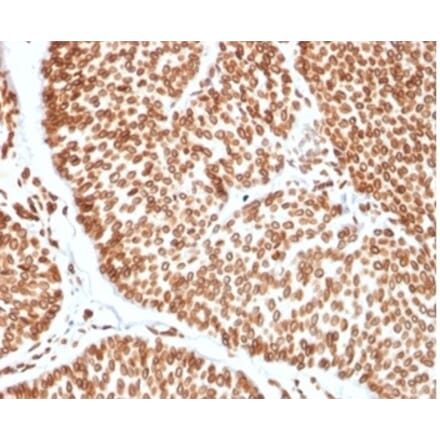 Immunohistochemistry - Anti-TCF4 Antibody [TCF4/2252] (A277818) - Antibodies.com