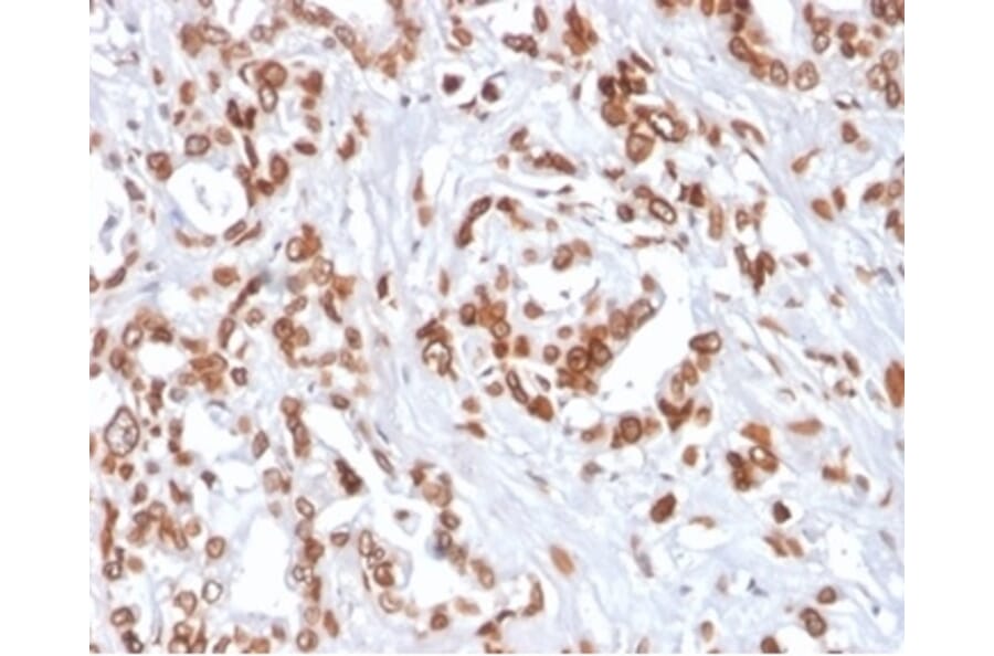 Immunohistochemistry - Anti-TCF4 Antibody [TCF4/2252] (A277818) - Antibodies.com