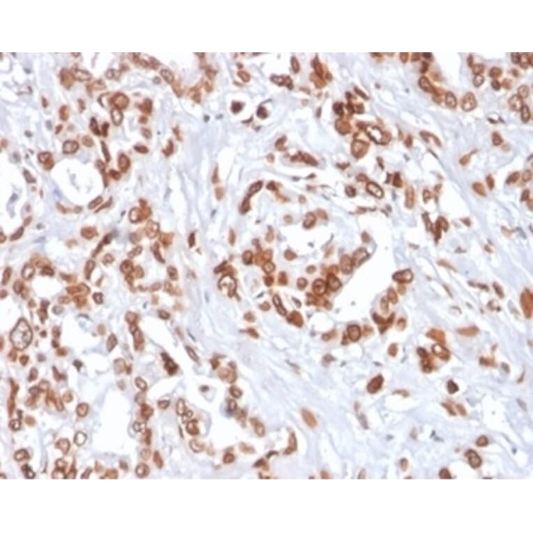 Immunohistochemistry - Anti-TCF4 Antibody [TCF4/2252] (A277818) - Antibodies.com
