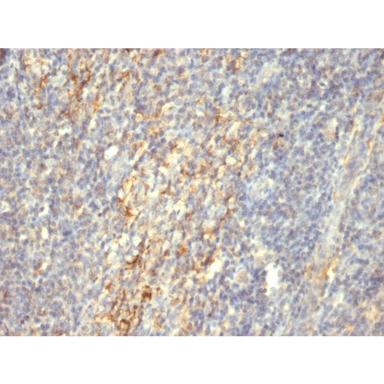 Immunohistochemistry - Anti-Transglutaminase II Antibody [SPM592] (A277819) - Antibodies.com