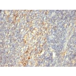 Immunohistochemistry - Anti-Transglutaminase II Antibody [SPM592] (A277819) - Antibodies.com