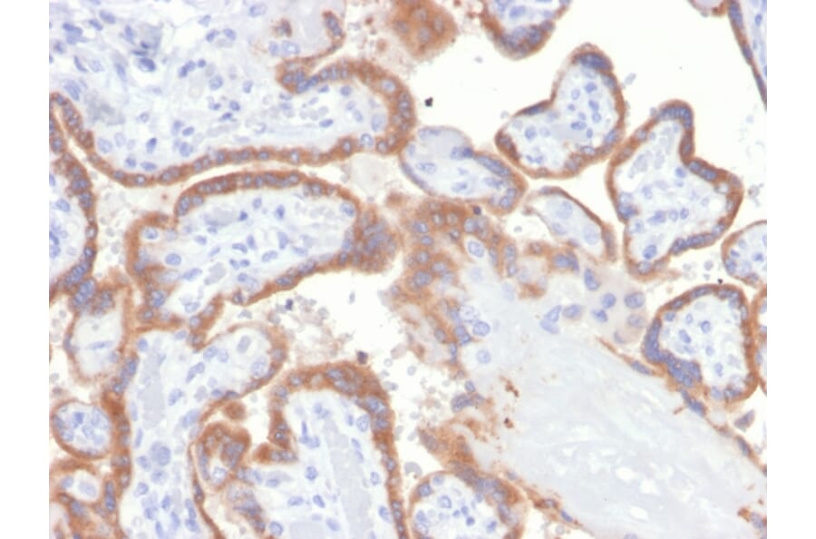Immunohistochemistry - Anti-TIMP2 Antibody [TIMP2/4477] (A277821) - Antibodies.com