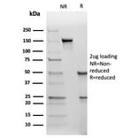 SDS-PAGE - Anti-TIMP2 Antibody [TIMP2/4477] (A277821) - Antibodies.com