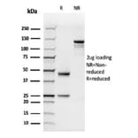 SDS-PAGE - Anti-C1QB Antibody [C1QB/2962] (A277822) - Antibodies.com